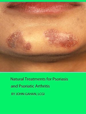 cover image of Natural Treatments for Psoriasis and Psoriatic Arthritis